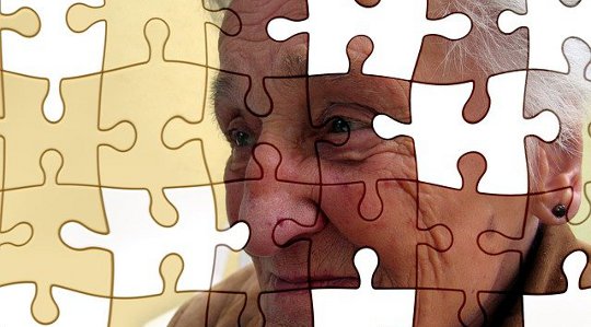 More Evidence Links Alzheimer’s and Diabetes More Evidence Links Alzheimer’s and Diabetes