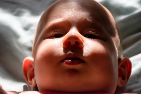 Childhood Obesity: It’s Not Just About Food face of an overweight child