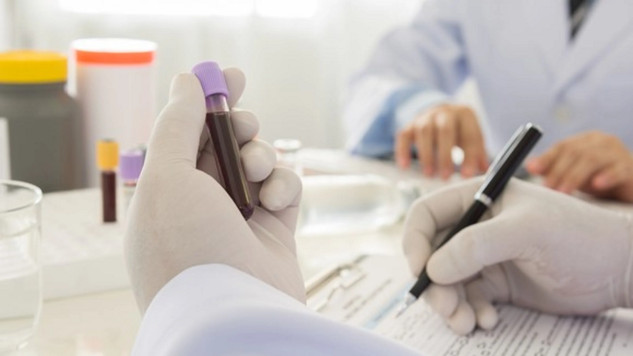 Early Cancer Detection: How a New Test Can Save Lives early cancer detection 11 2