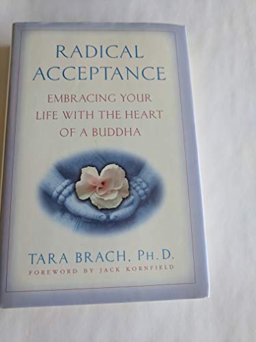 Radical acceptance