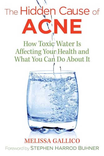 The hidden cause of acne